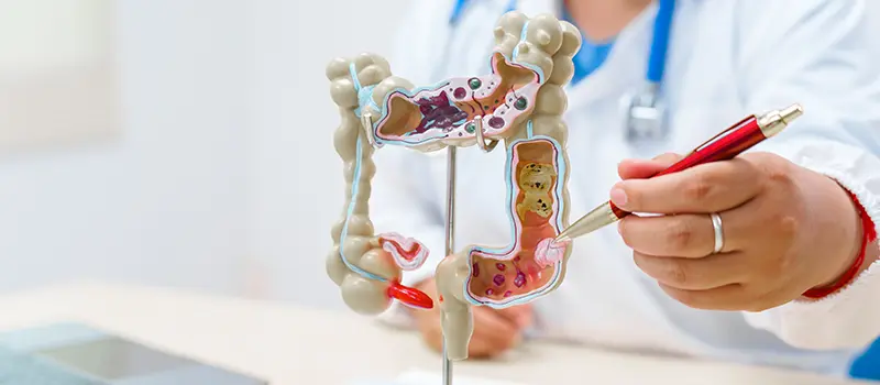 Colorectal Surgery